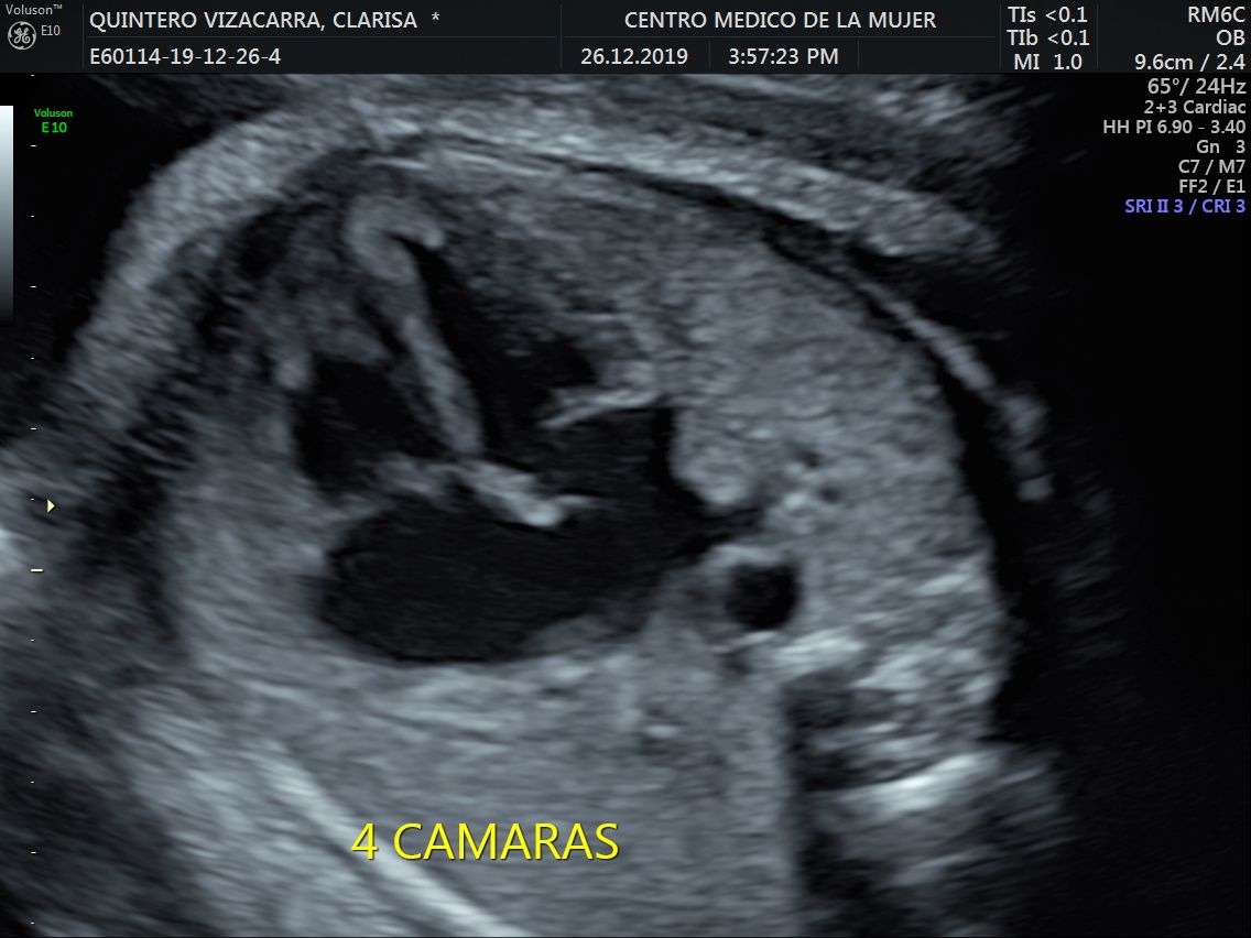 Julio Cesar Monárrez Martín-21