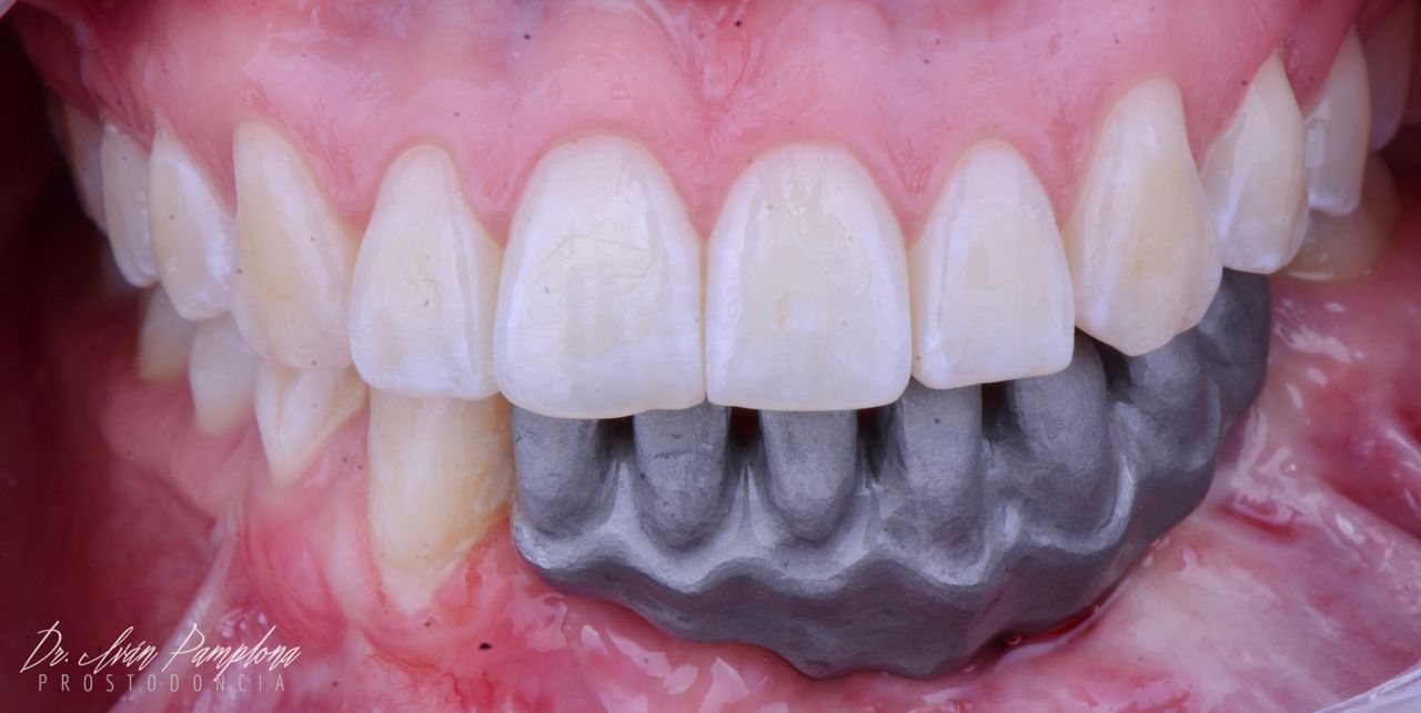 Iván Gerardo Pamplona Alfaro-24