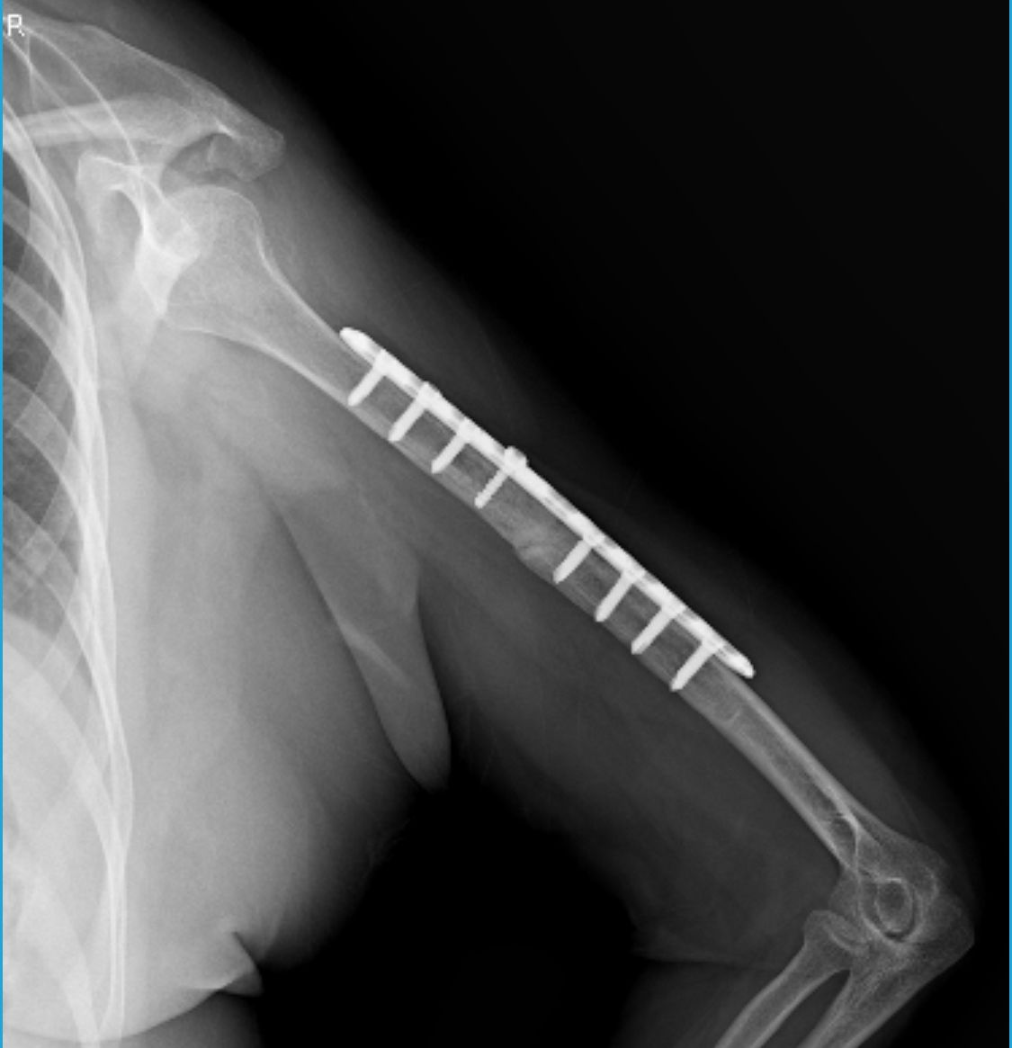 Alberto Lorenzo Cortés-8