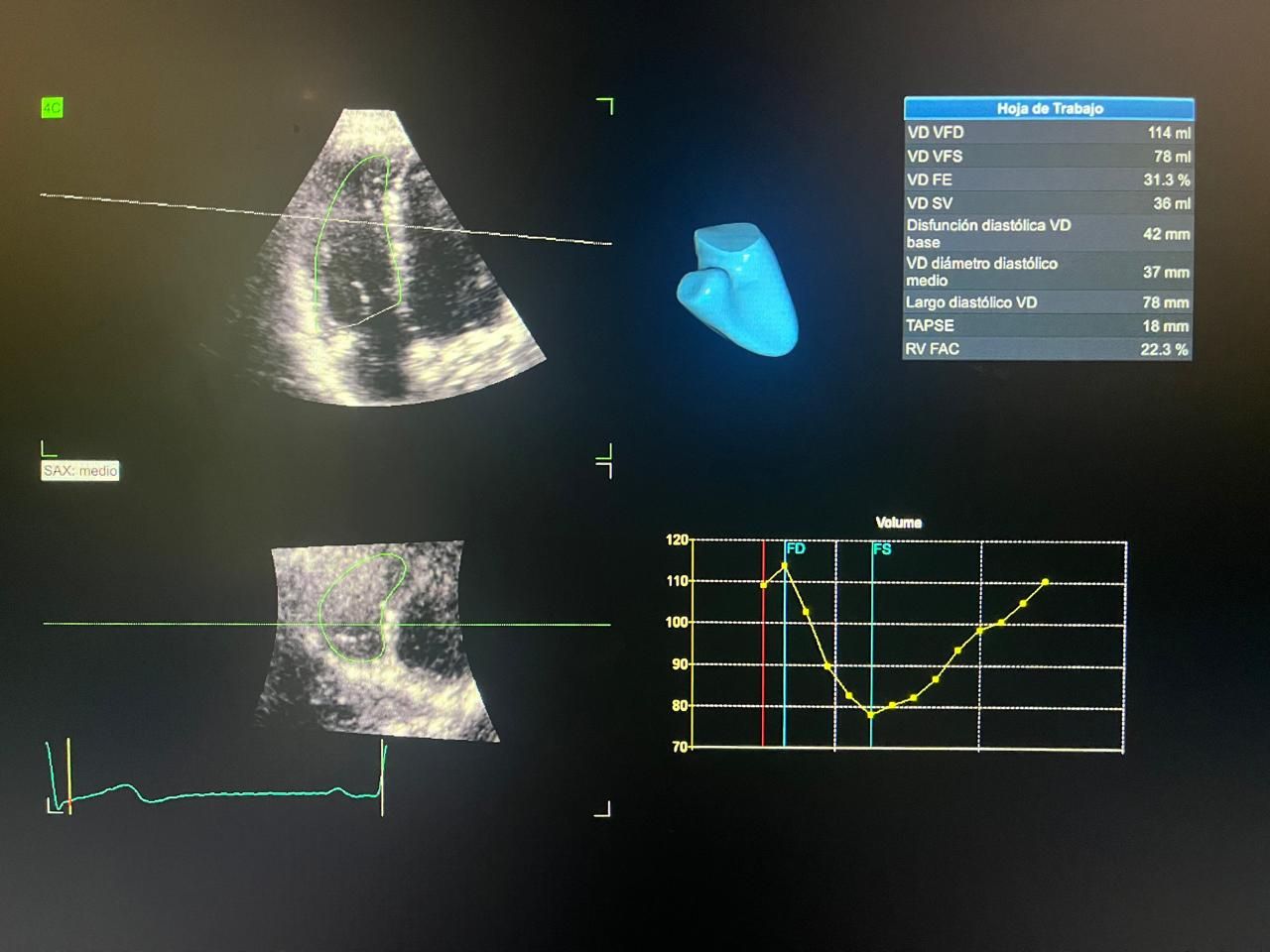 Alba Melina Ascañio Flores-2