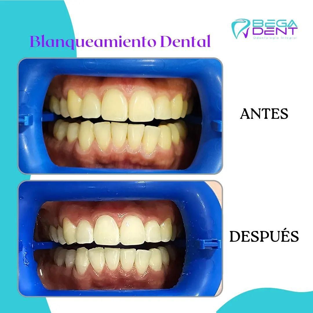 Laura Karla Becerra Gamiño-26