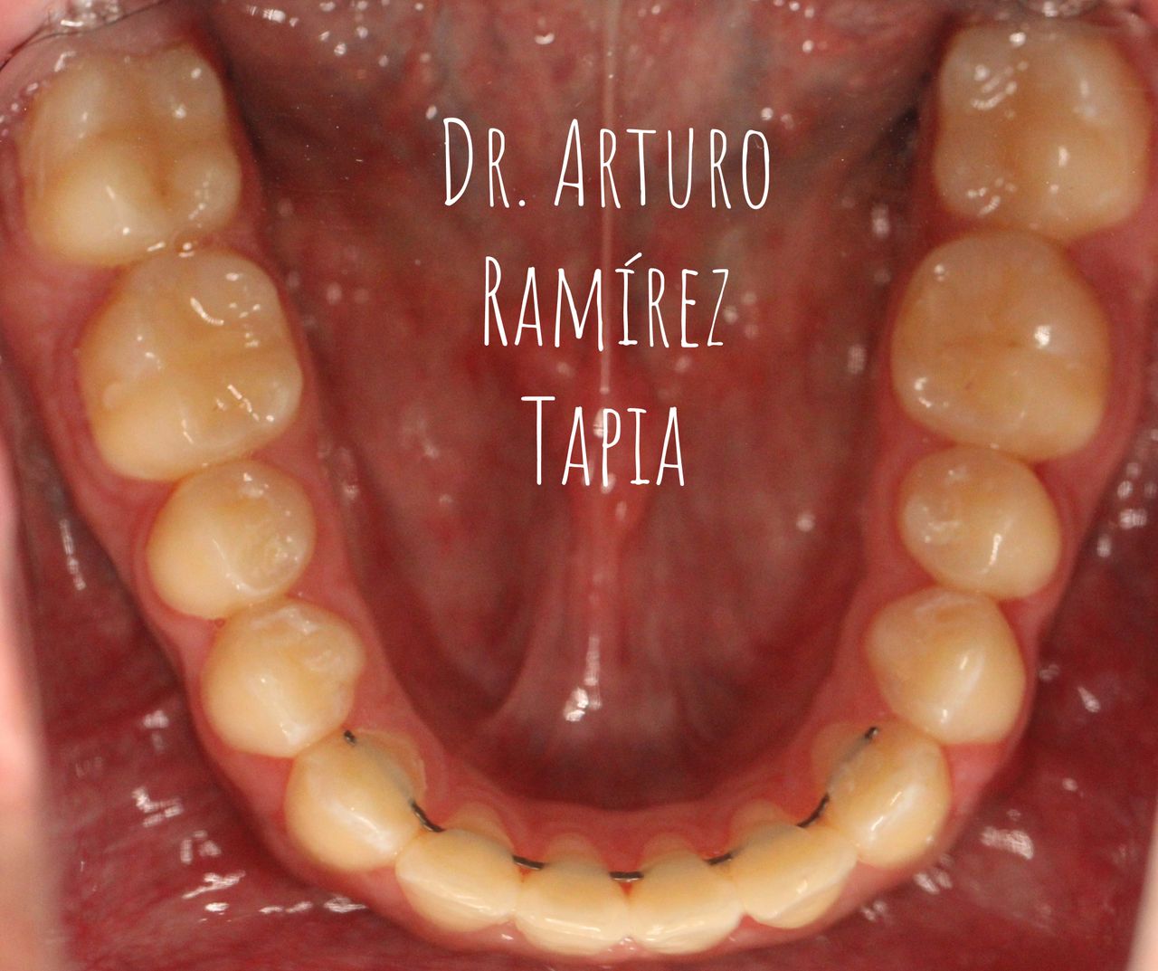 Arturo Ramírez Tapia-20