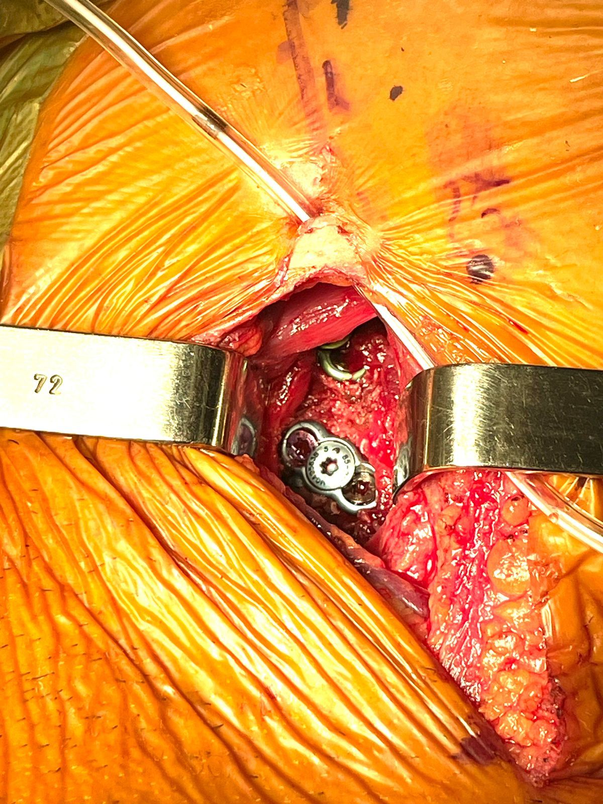 Gerson Reyes Rodríguez-18