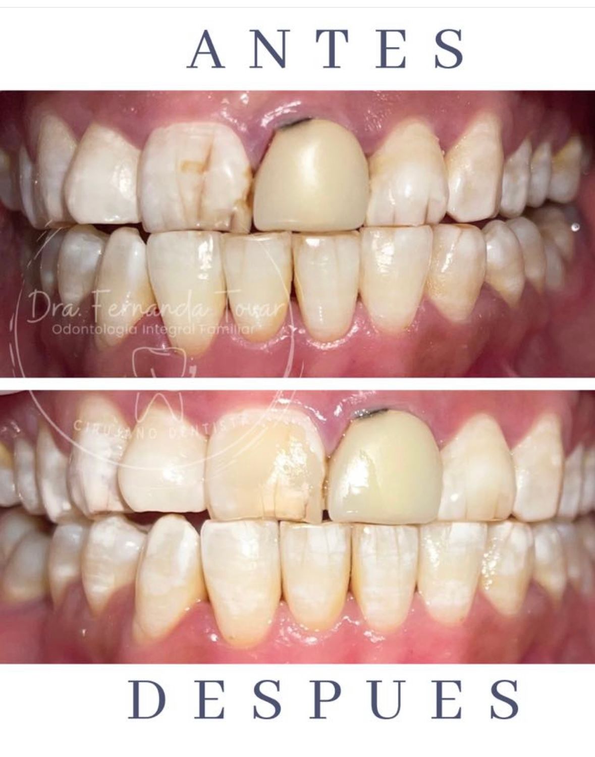 Fernanda Tovar Navarro-4