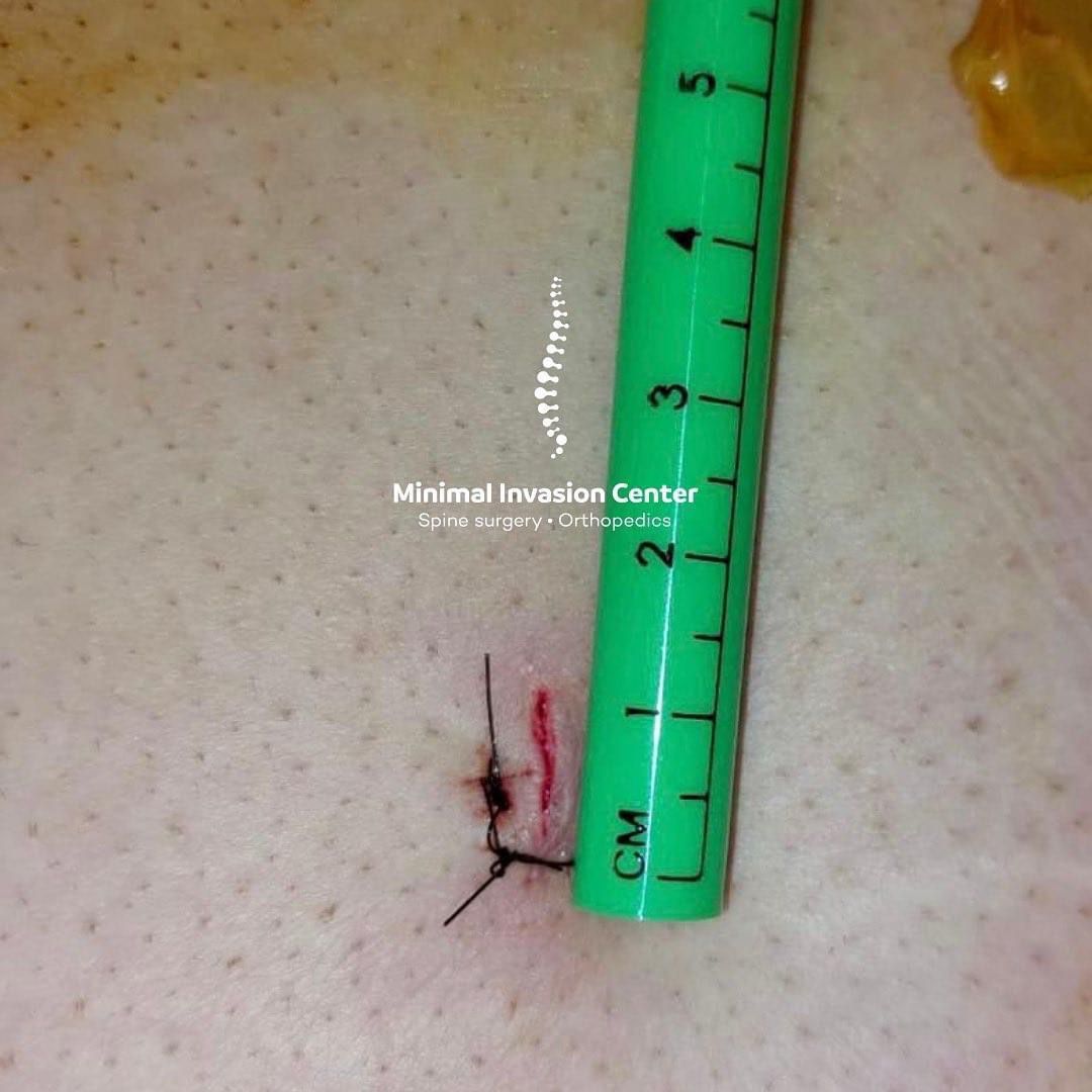 Omar Marroquín Herrera-27