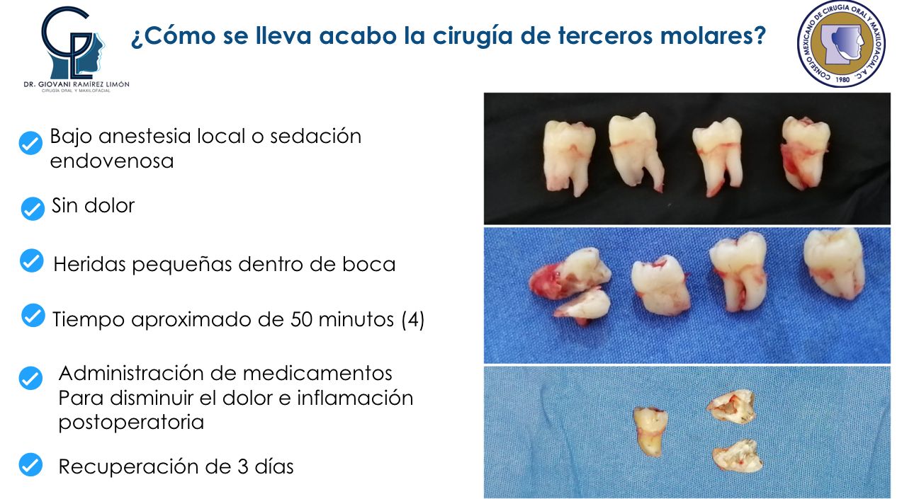 Giovani Ramírez Limón-33