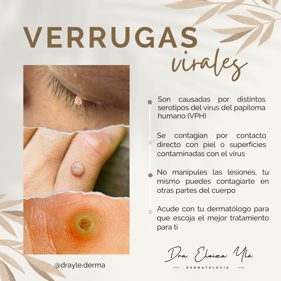 Eloiza Lizeth Ylé Arámburo-6