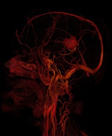 Marco Antonio Díaz Montoya-7