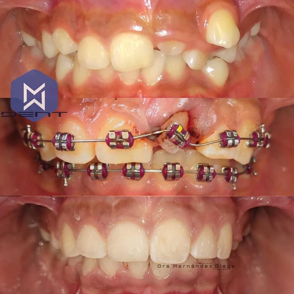 Marvin Adair Hernández Álvarez-49