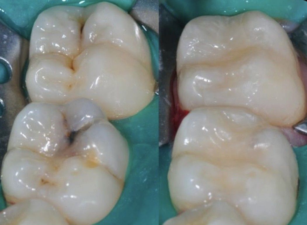 Esmeralda Candida Guerrero Pimentel-13