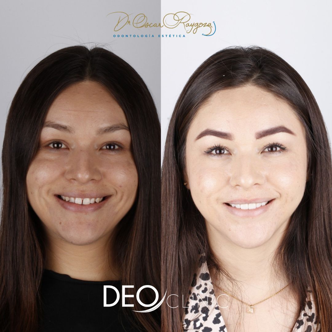 Oscar Raygoza Carrillo-67