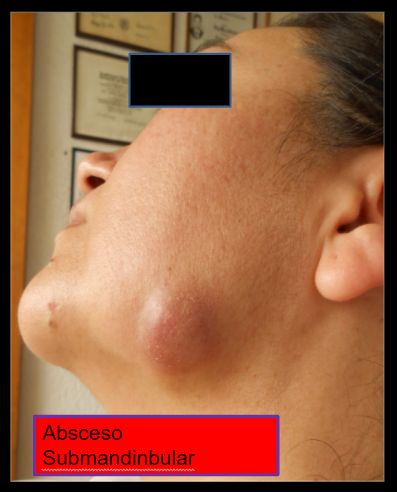 Diana Araceli Dávila Hernández-24