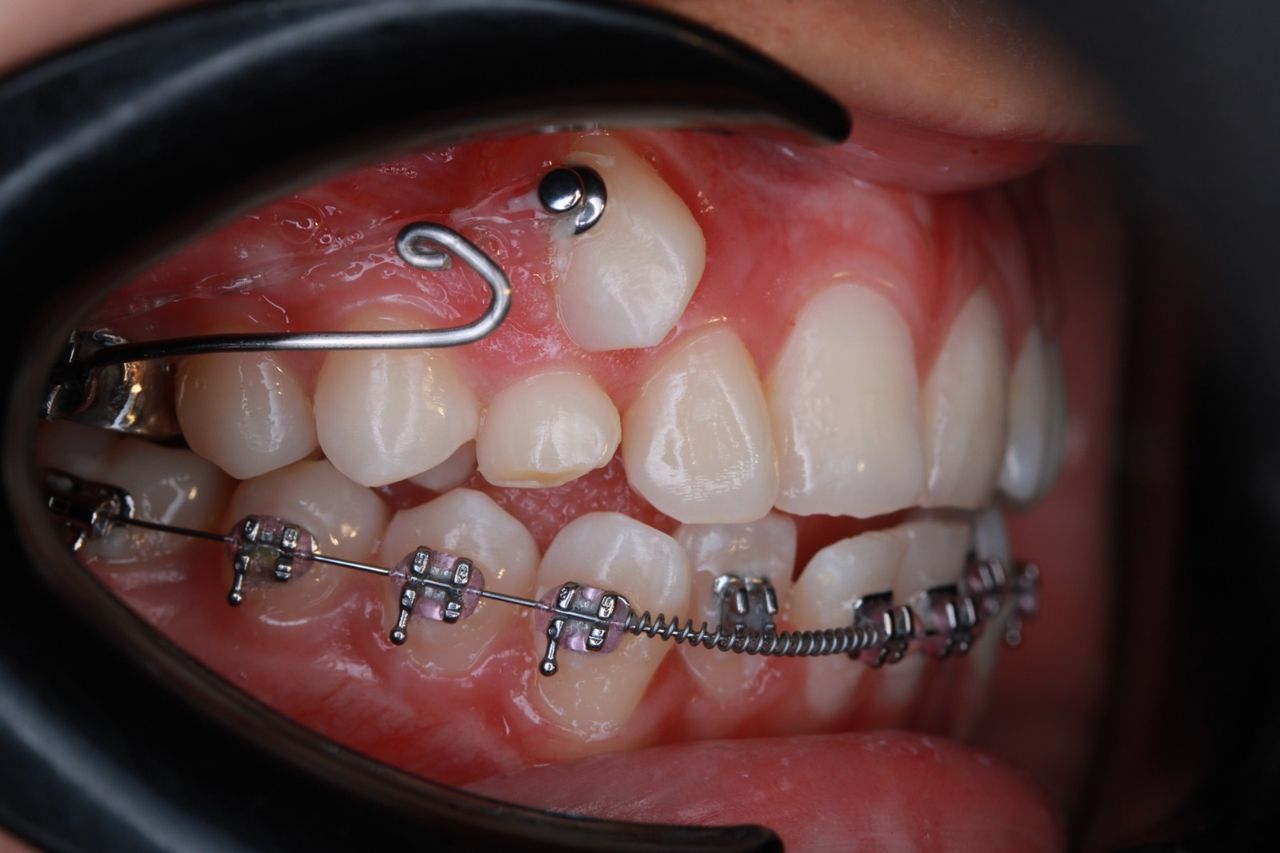 César Osvaldo Poot Chan-6