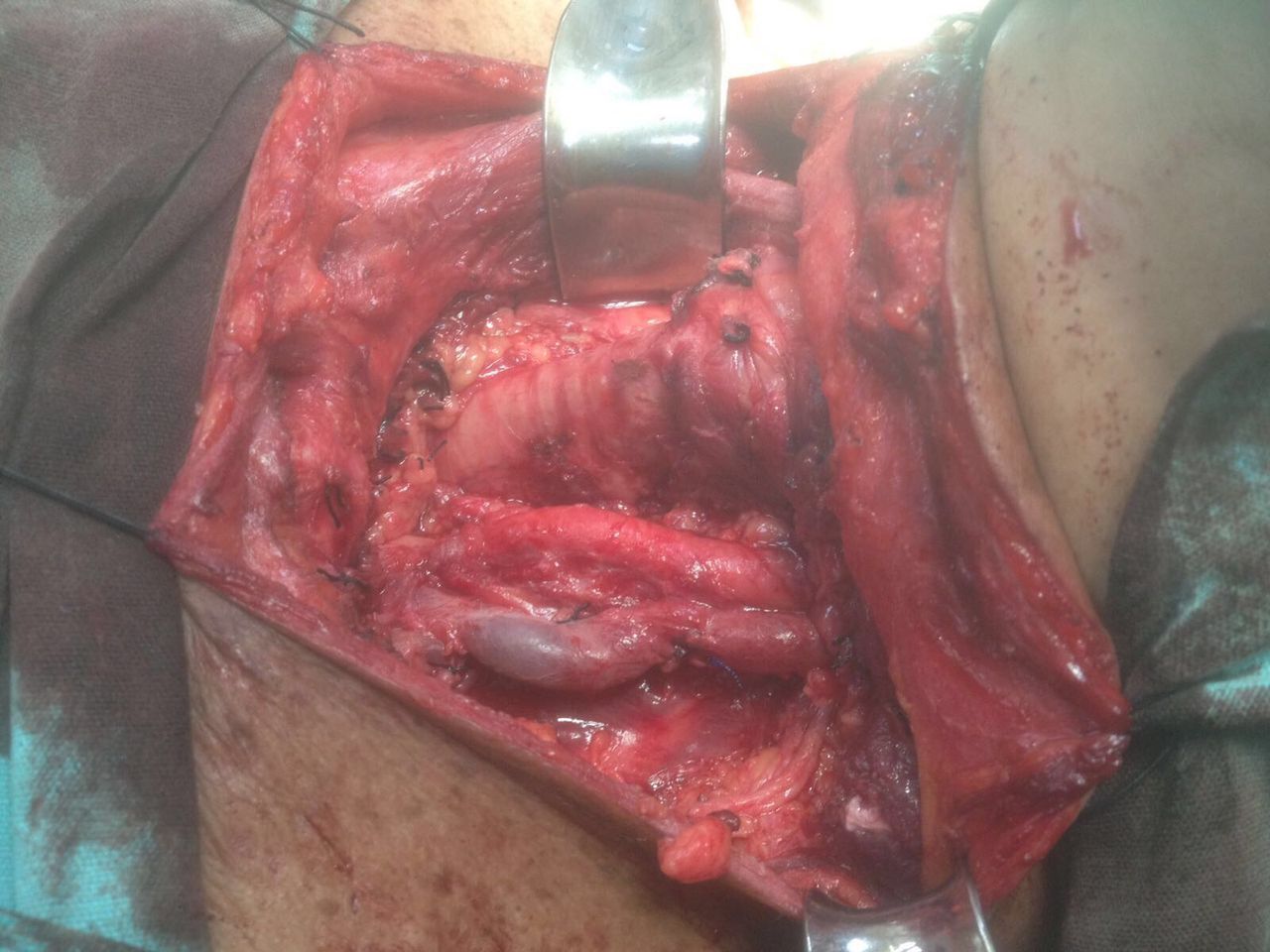 César Espejel Valdés-29