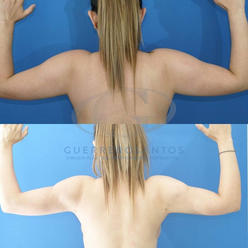 Fernando Guerrerosantos-19