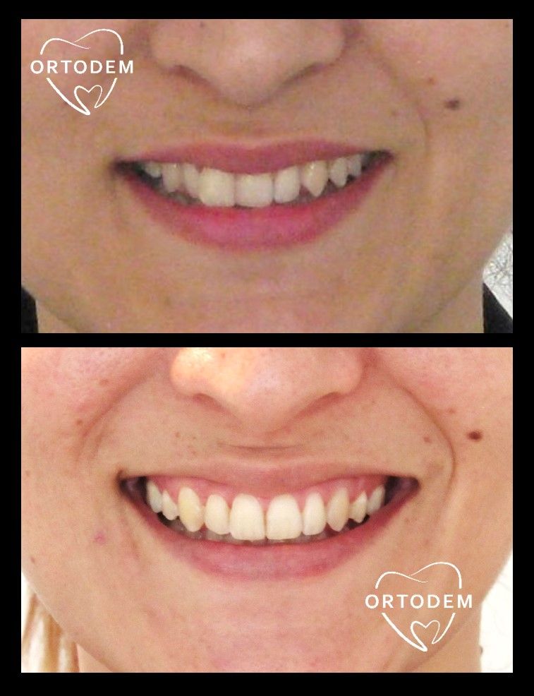 Elizabeth Morelos Morales-4