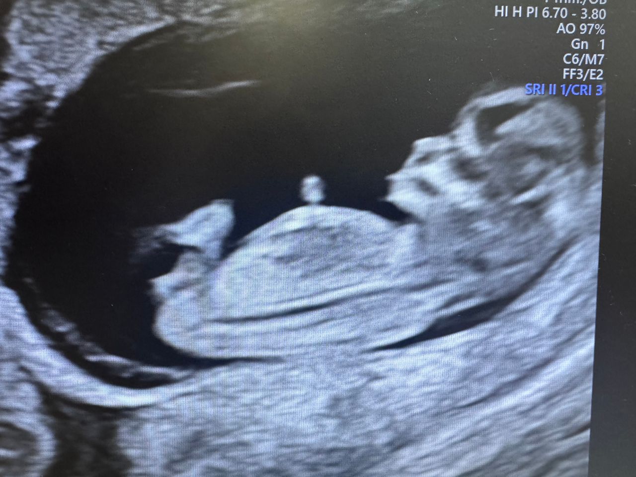 Abraham Gilberto Garcia Peña-1