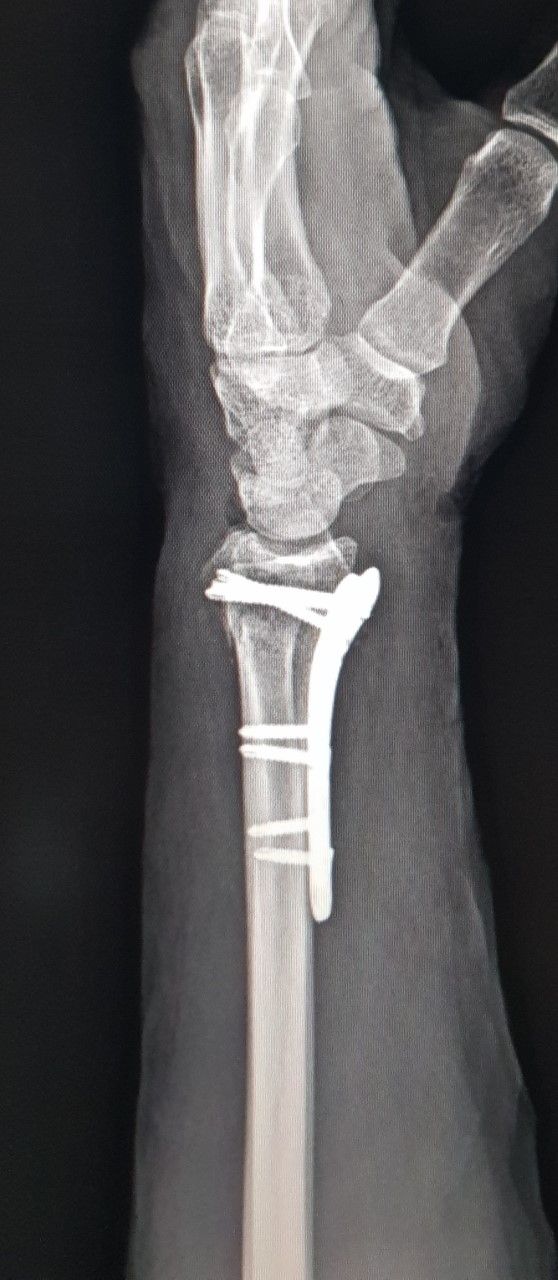 Gilberto Hernández Ortega-48