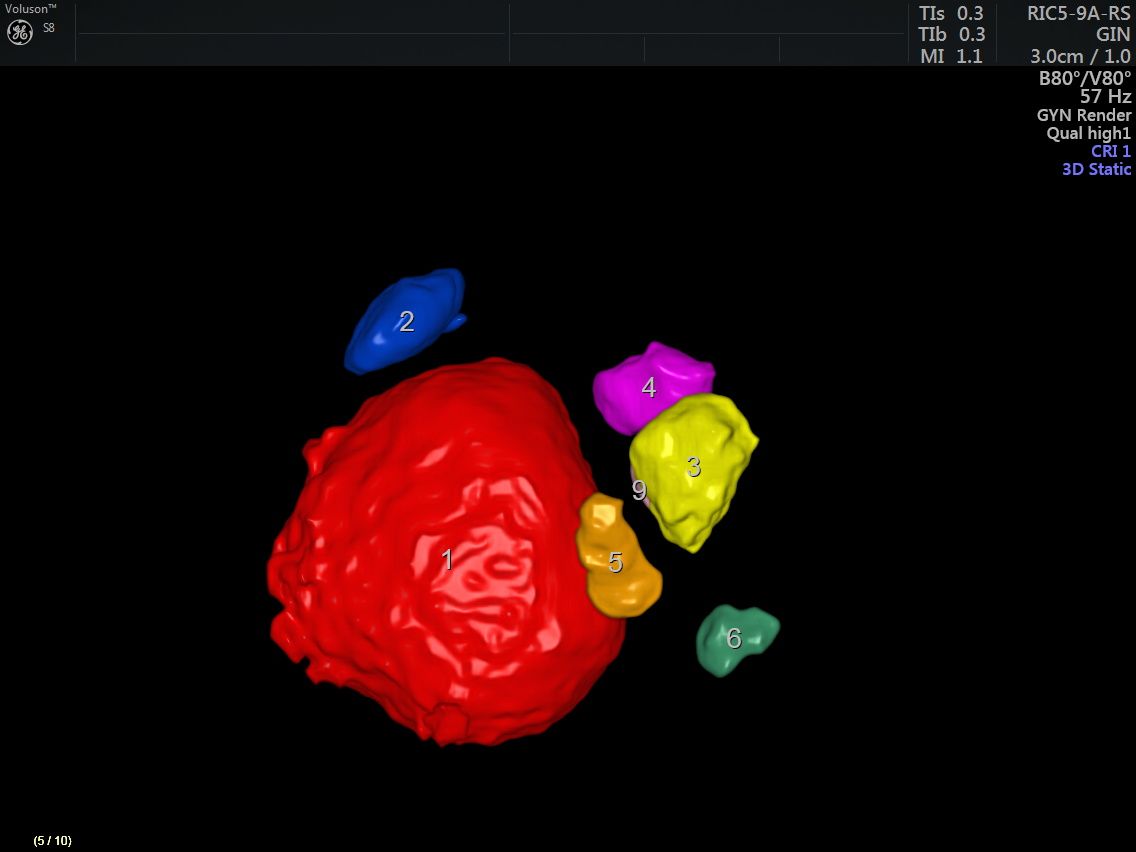 Griselda Reyes Torres-75