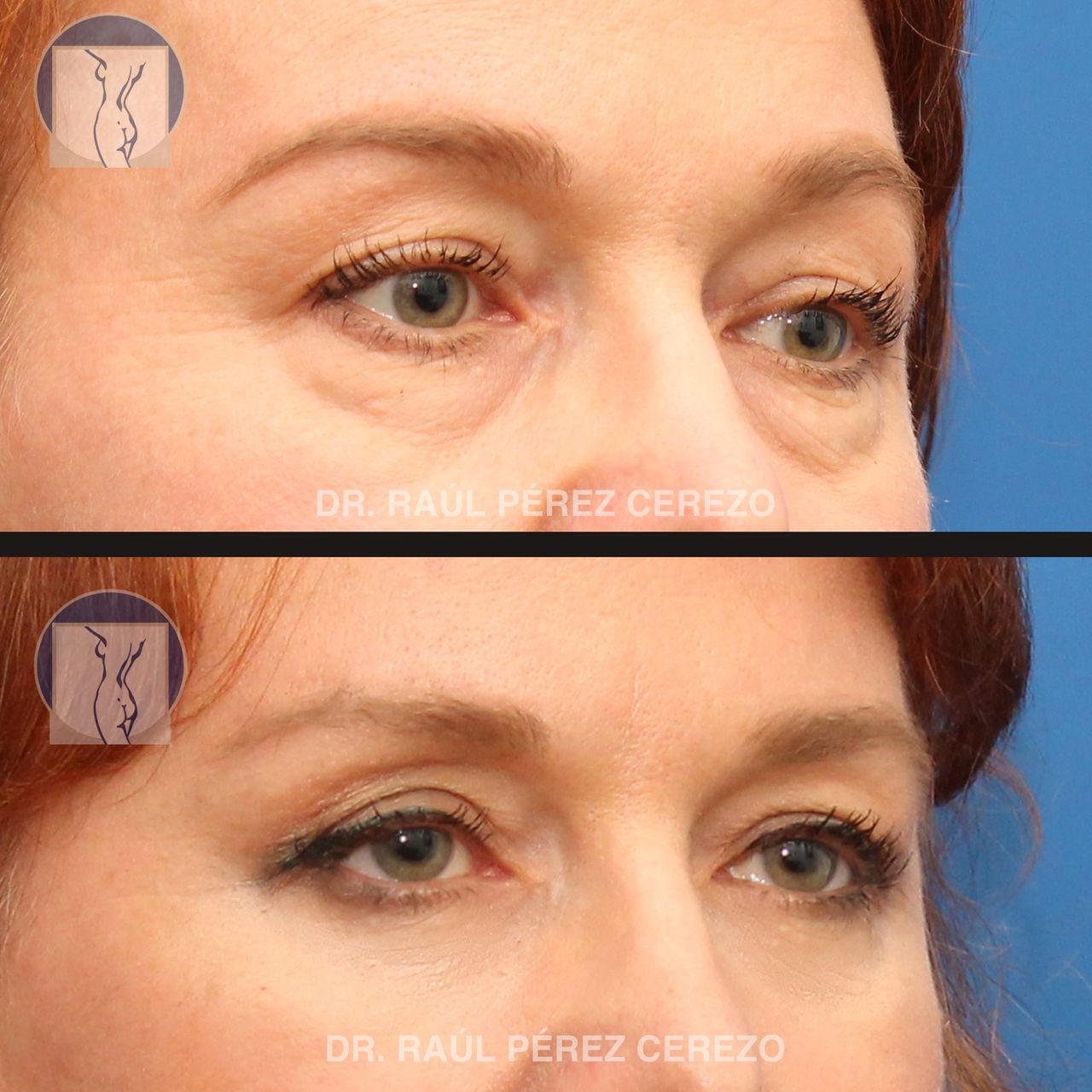 Raúl Pérez Cerezo-8