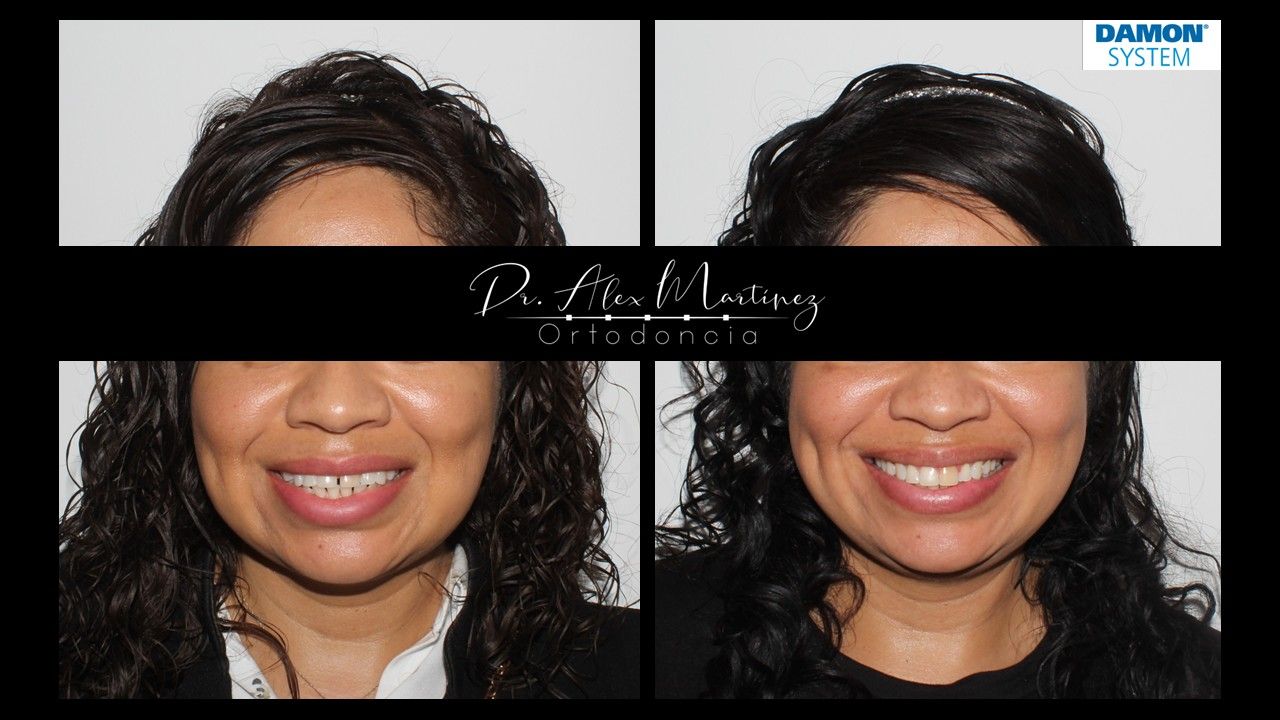 Alejandro Martínez Hernández-18