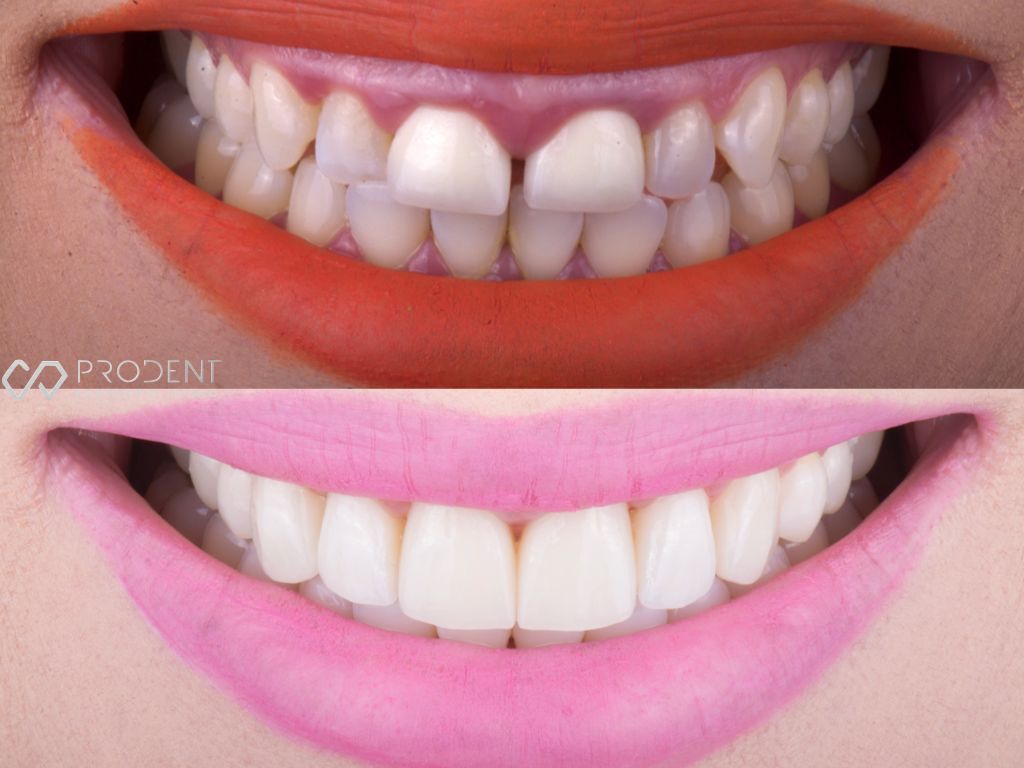 Ramiro Ivan Pérez Murillo-8