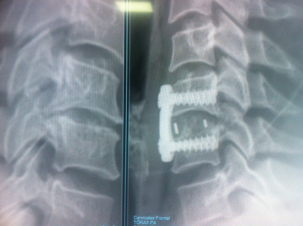 Erick Jimmy Vega Delgadillo-0