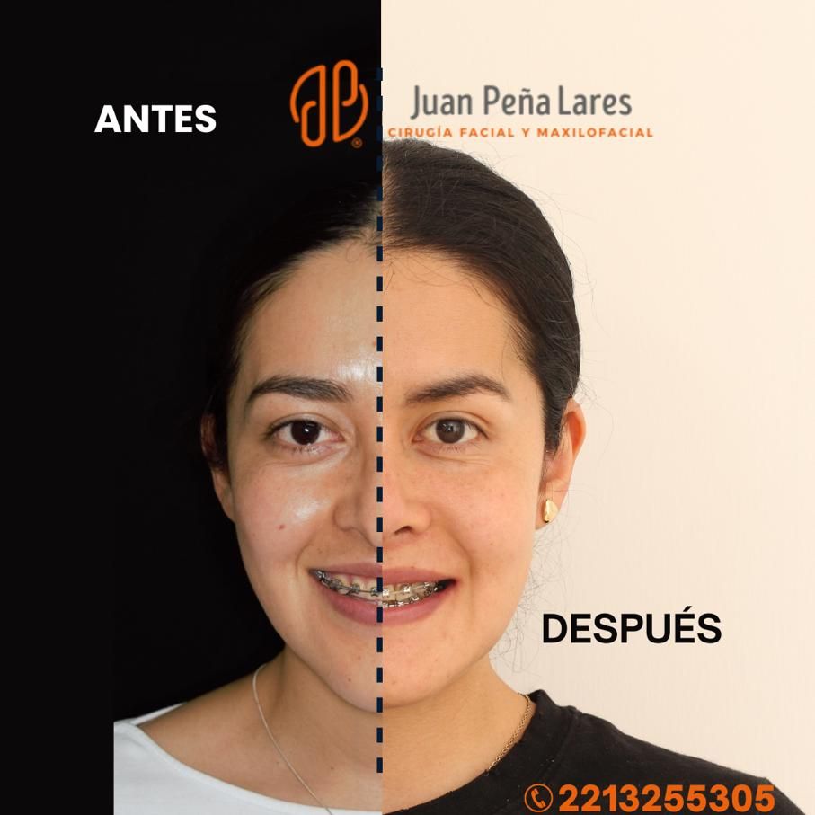 Juan Peña Lares-15