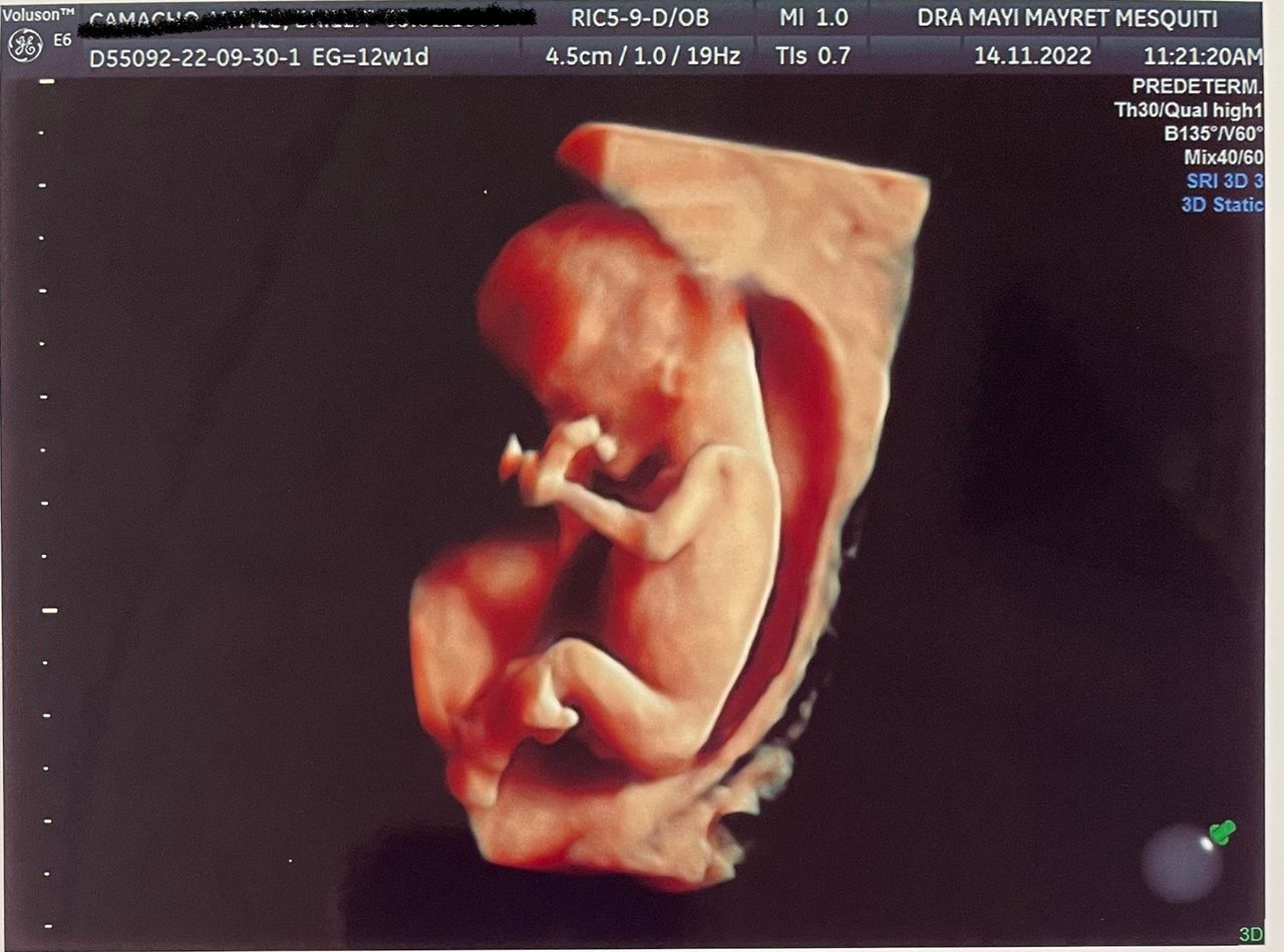 Mayi Mayret Mesquiti-7