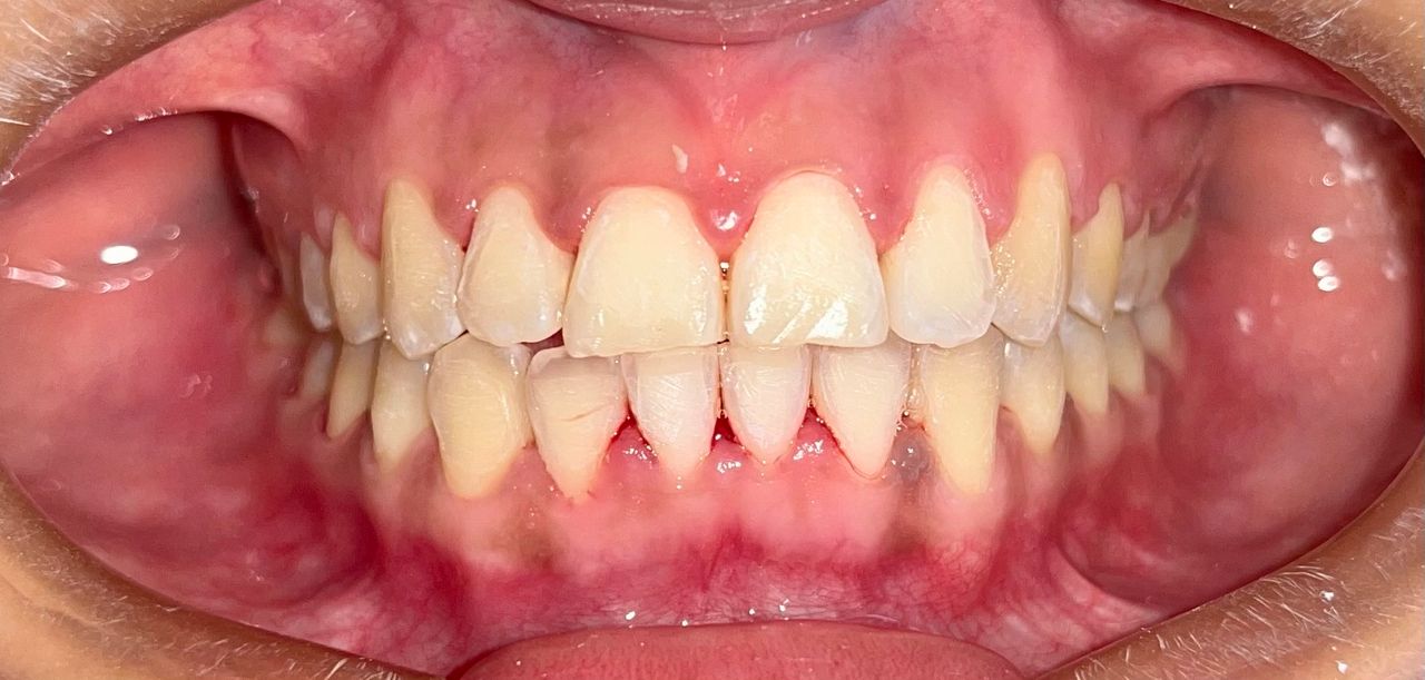 Zoe Guadalupe  Hernandez Aguilar-2