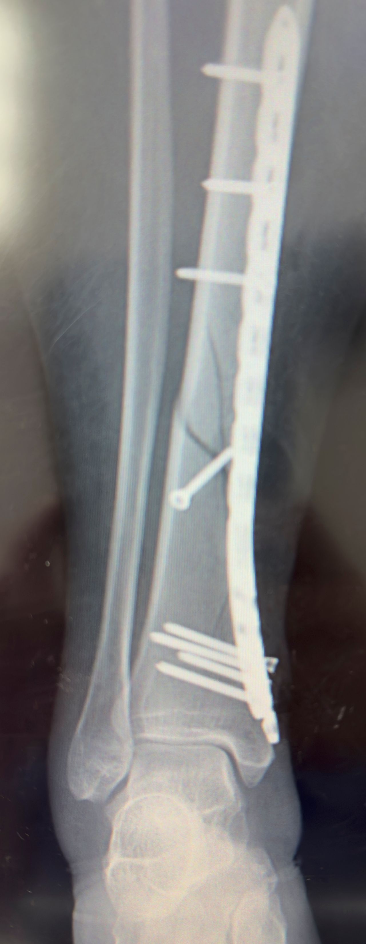 Ana Judith Jhotzely Lozano Reyes-5