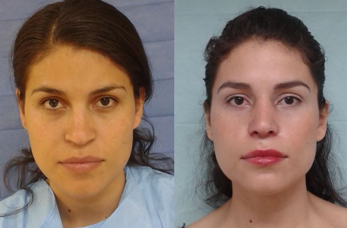 Marisol Ceja Zepeda-46