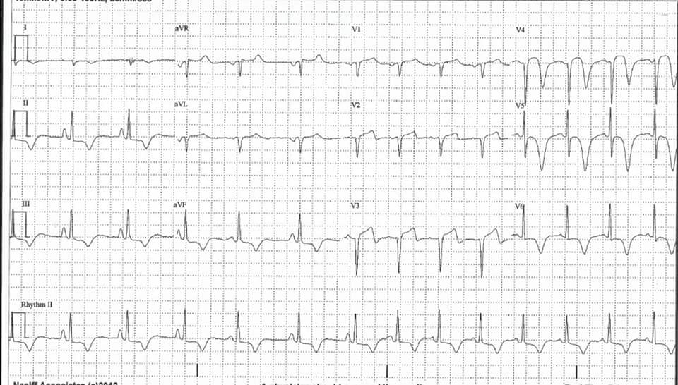 Alfredo Lugo Villa-3