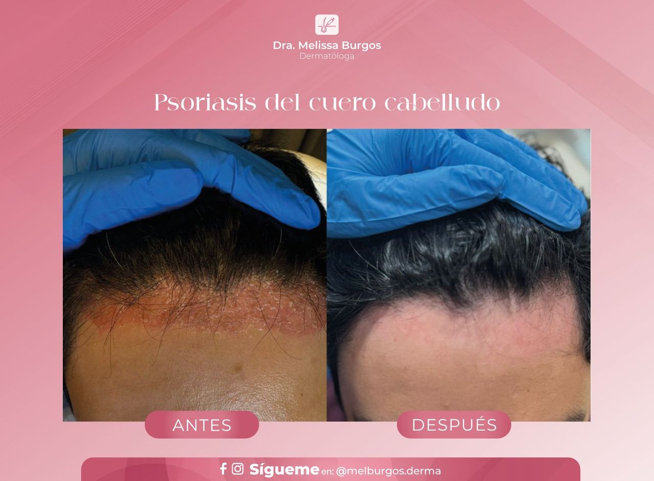 Melissa Burgos Romero-10