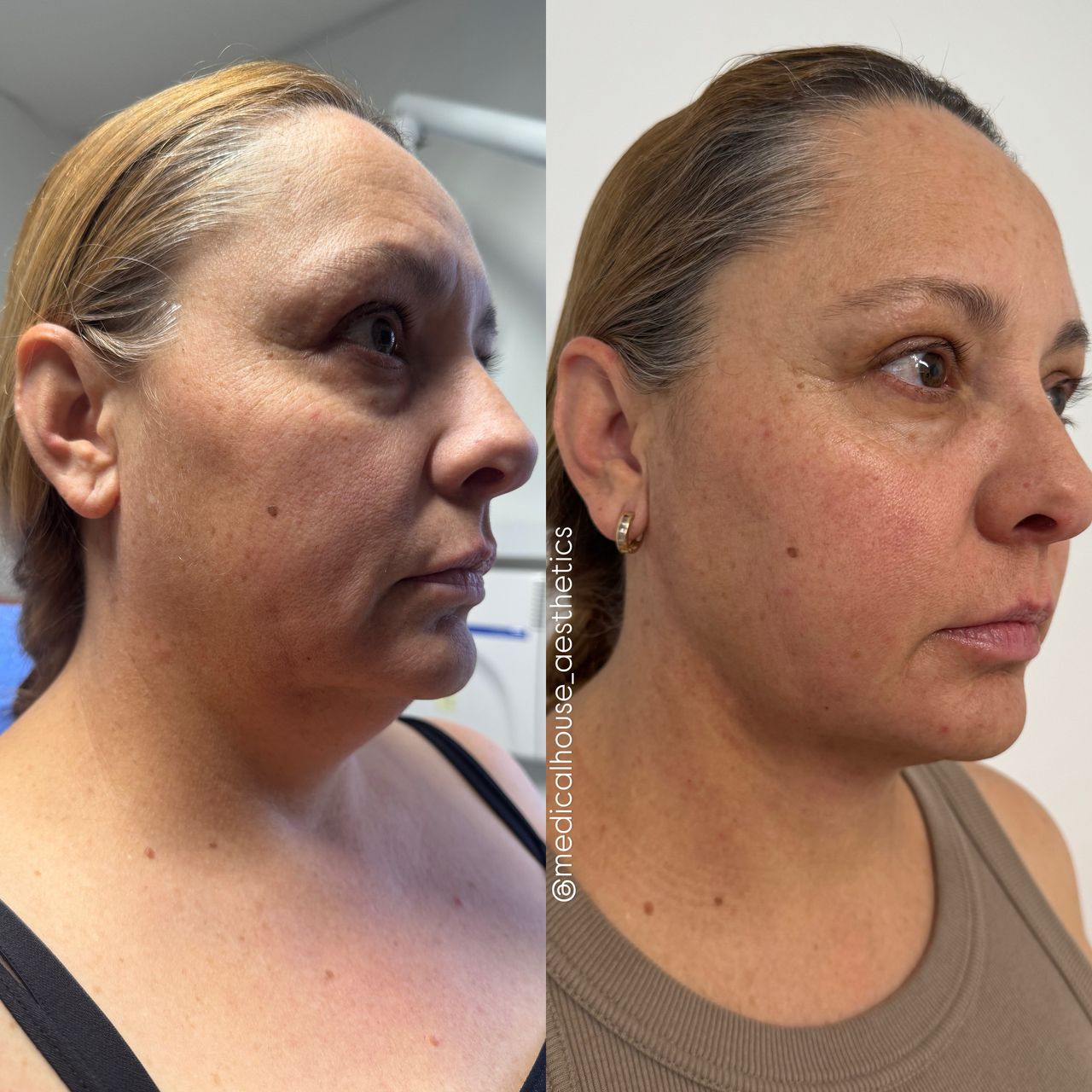 Miguel Angel Aguirre-13