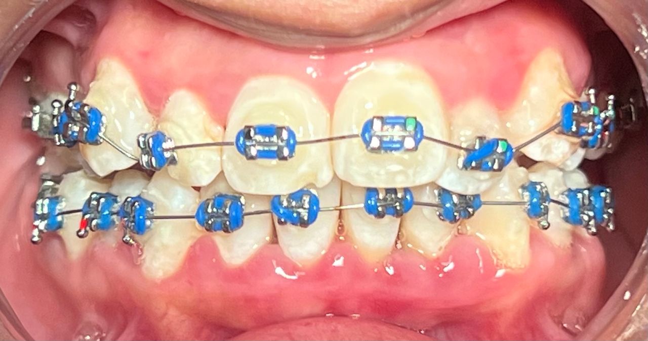 Gloria Haydee Castillo Castellanos-3