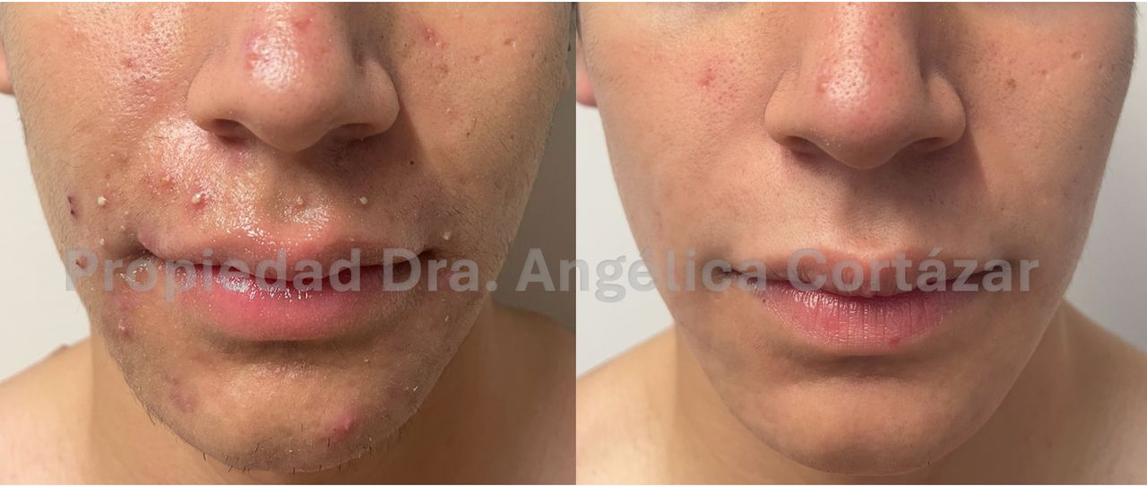 Angélica María Cortázar Azuaje-10