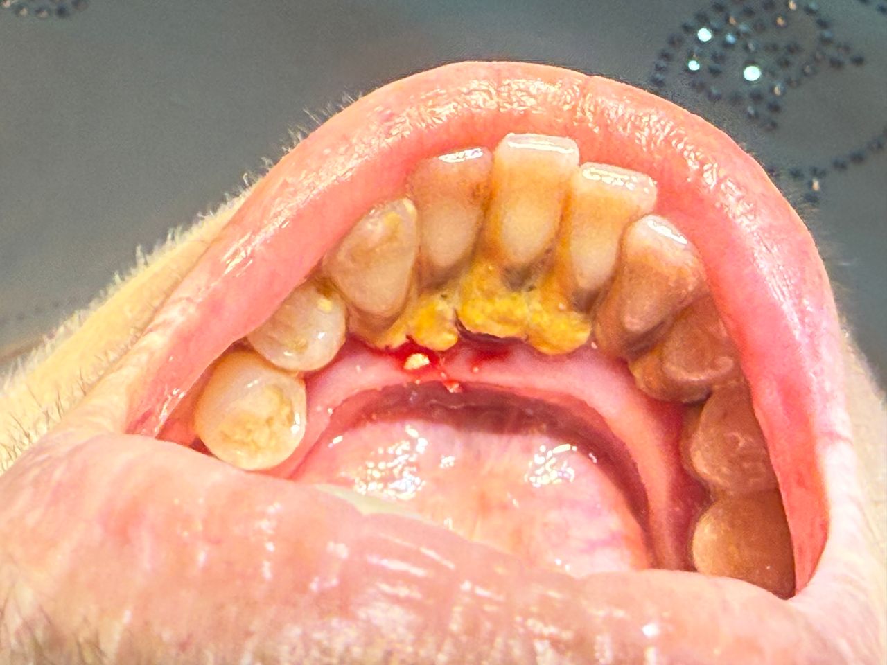 Eduardo López Méndez-55