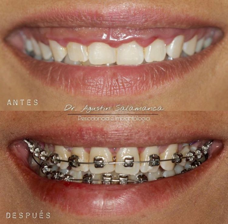 Agustin Salamanca Tapia-11