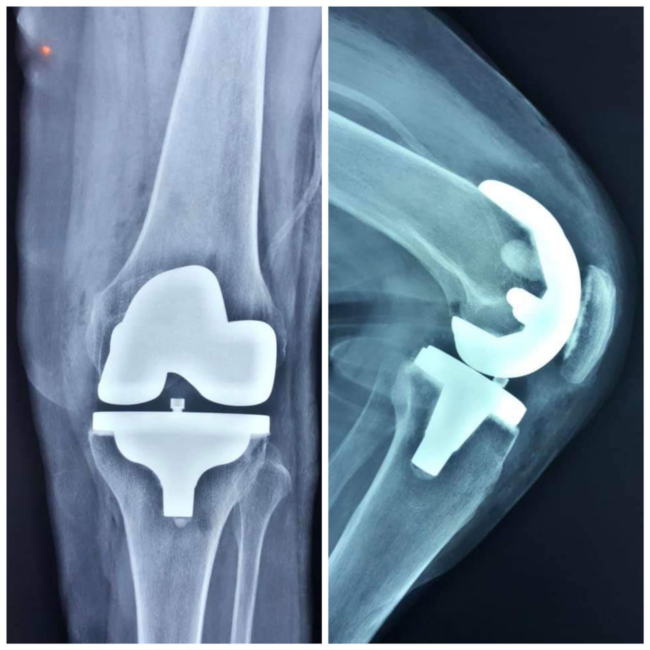 Alan Giovanni Polanco-9