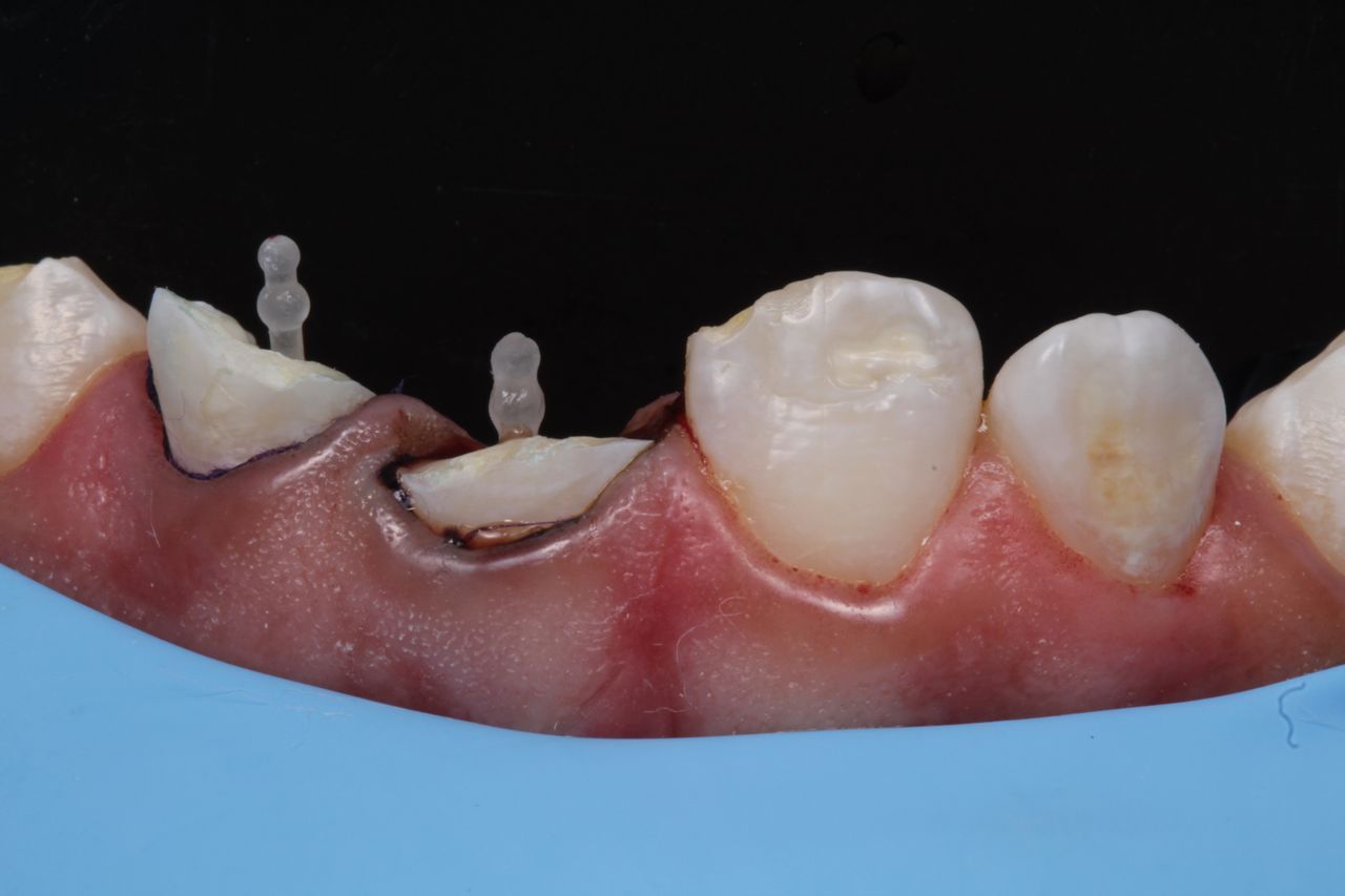 Fernando Fuentes Lozada-7