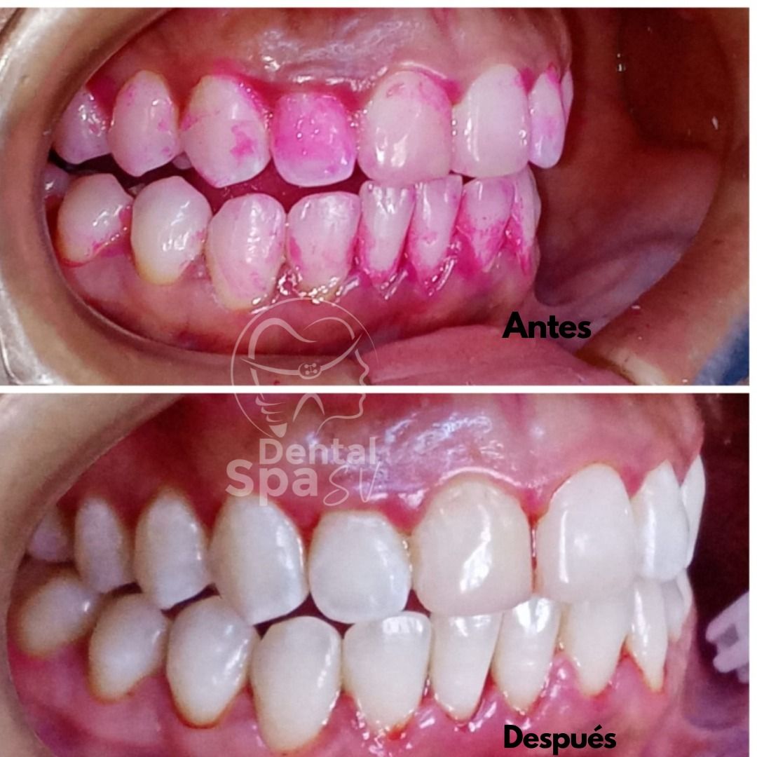 Zury Sarai Moreno Soto-26