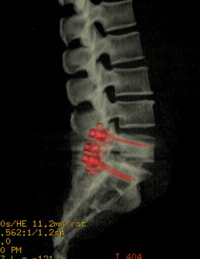 Griselda Collado Arce-7