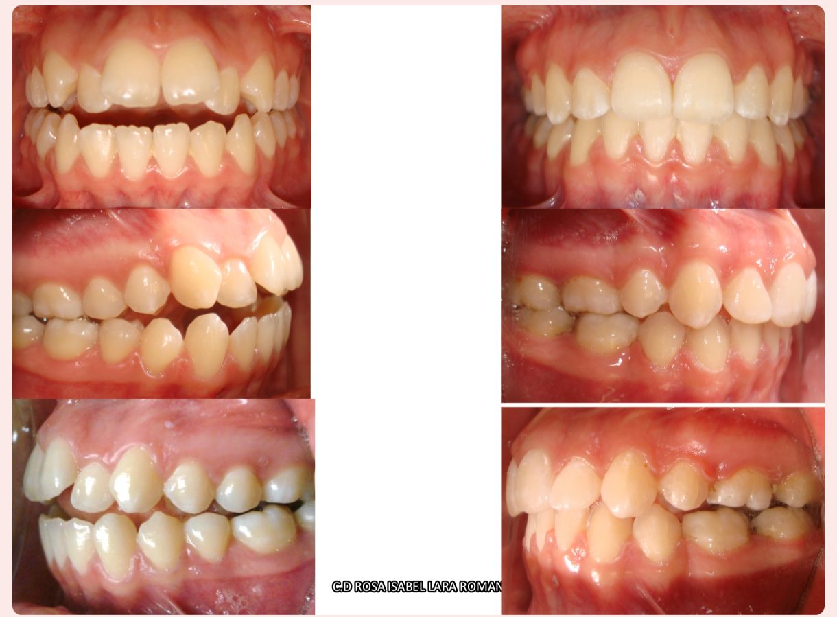 Rosa Isabel Lara Román-1