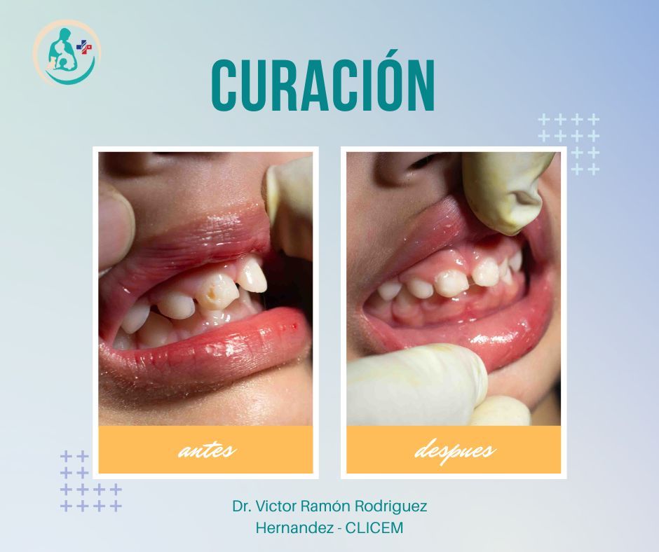 Victor Ramón Rodríguez Hernández-22