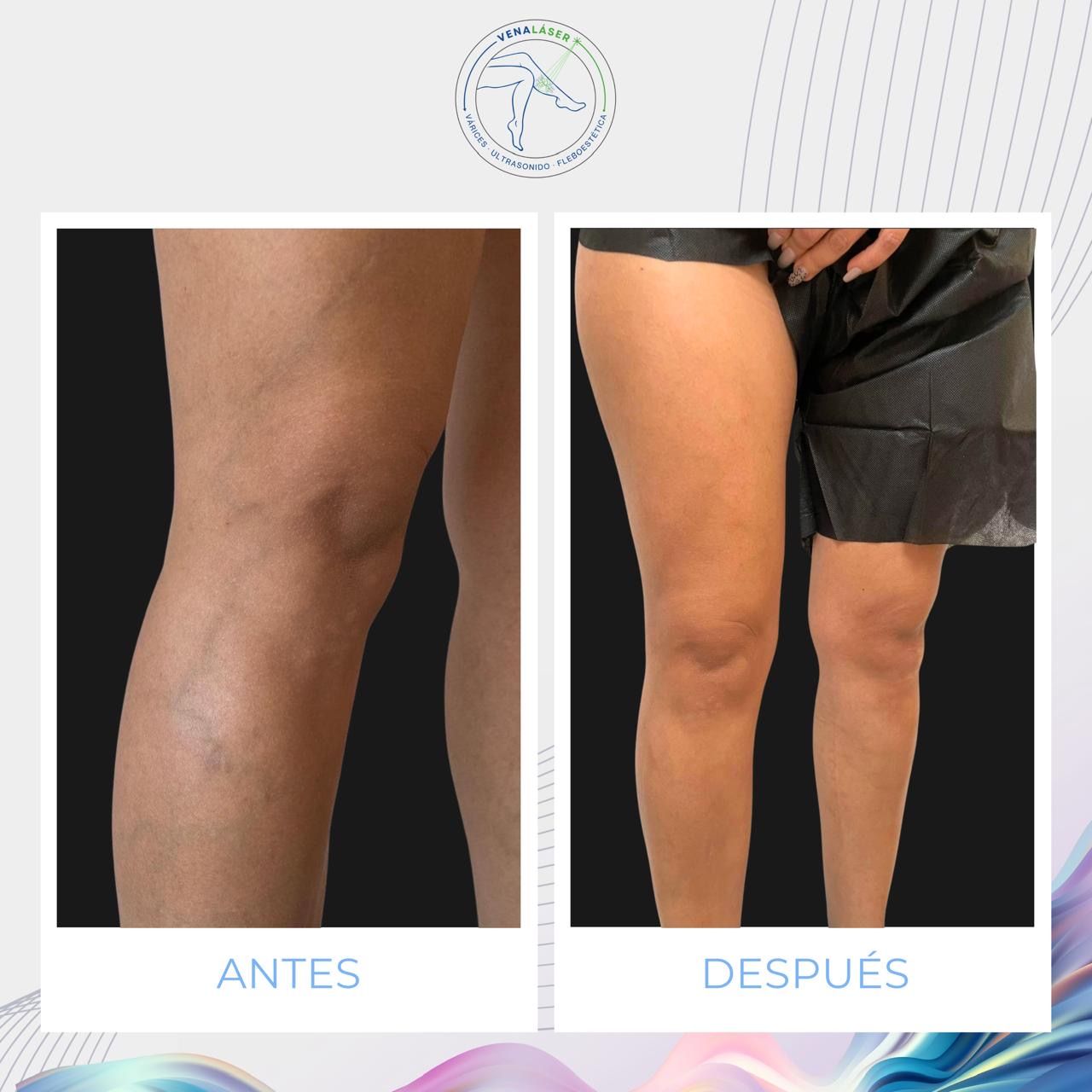 Mishell Eduardo Santander Becerra-9