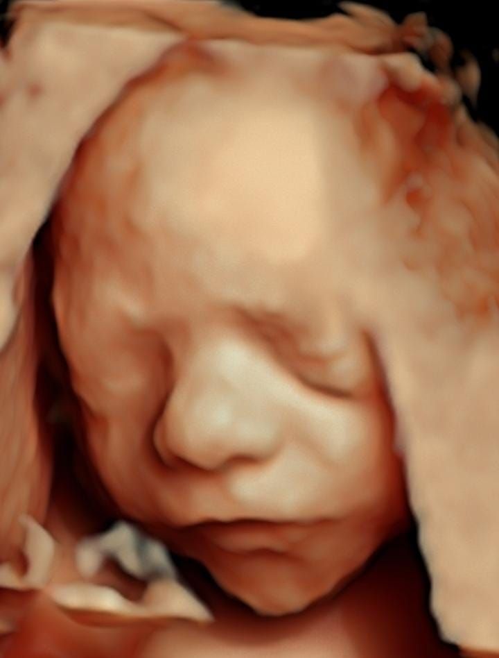 Iván André Guzmán Amador-4