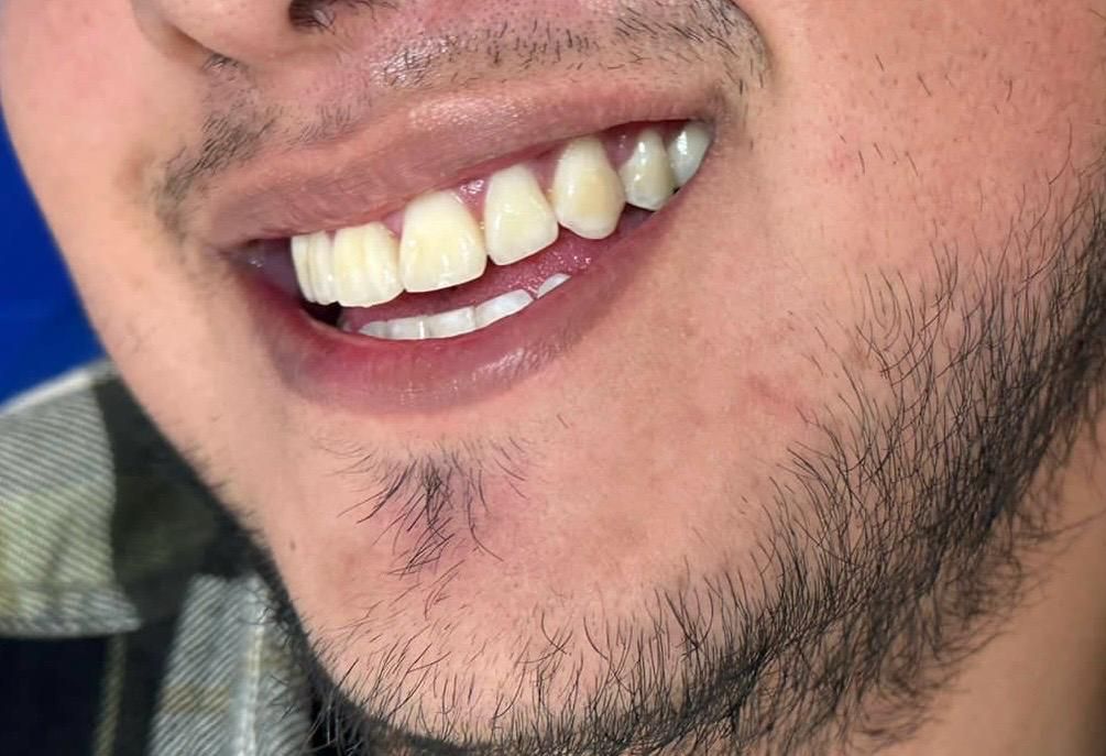 Anuar Becerril Castro-20