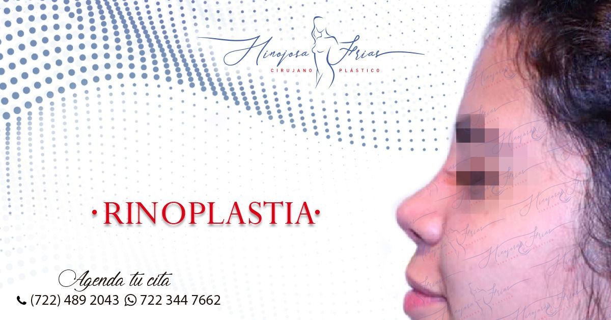 Miguel Ángel Hinojosa Frías-3