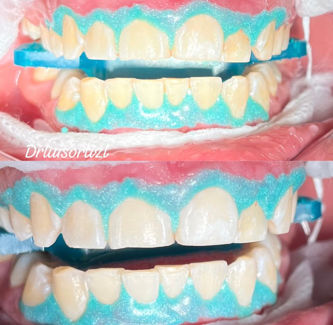 Luis Ángel Ortiz López-10